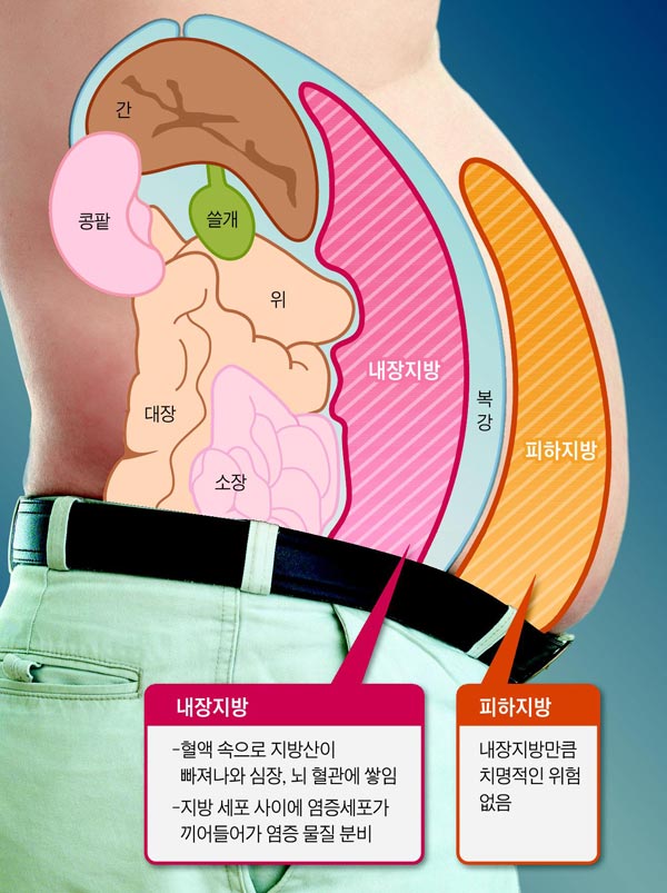 내장지방과 피하지방 설명 이미지